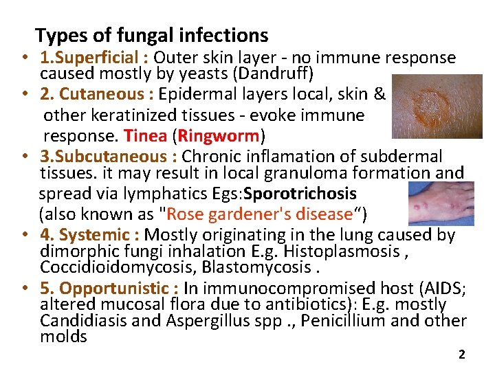  Types of fungal infections • 1. Superficial : Outer skin layer - no