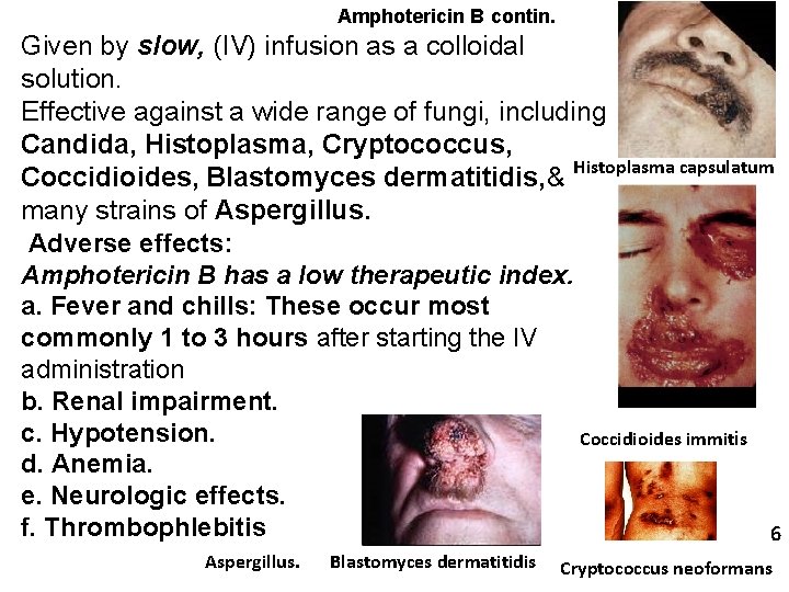 Amphotericin B contin. Given by slow, (IV) infusion as a colloidal solution. Effective against