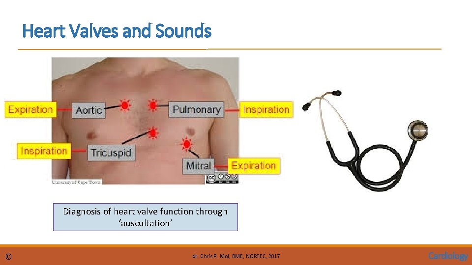 Heart Valves and Sounds Diagnosis of heart valve function through ‘auscultation’ © dr. Chris