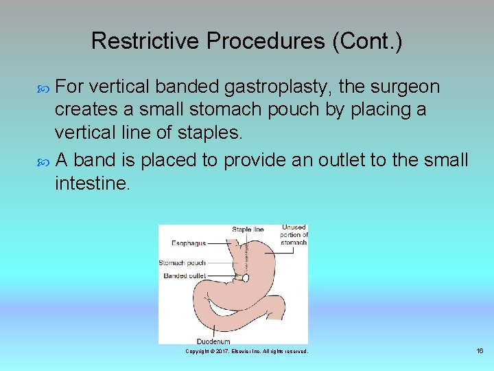 Restrictive Procedures (Cont. ) For vertical banded gastroplasty, the surgeon creates a small stomach