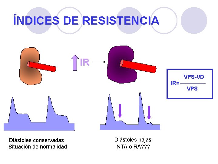 ÍNDICES DE RESISTENCIA IR VPS-VD IR= Diástoles conservadas Situación de normalidad Diástoles bajas NTA