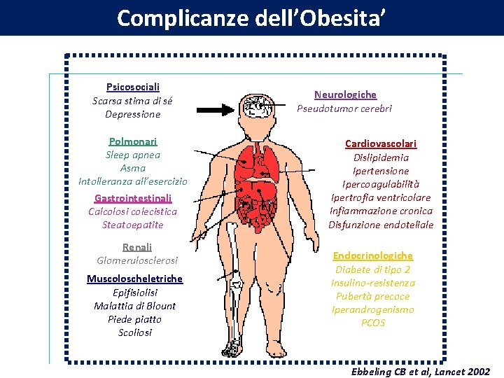 Complicanze dell’Obesita’ Psicosociali Scarsa stima di sé Depressione Polmonari Sleep apnea Asma Intolleranza all’esercizio