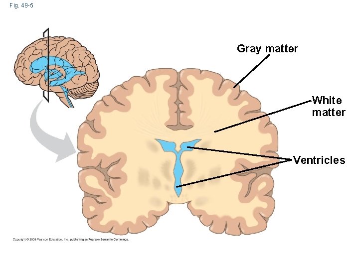 Fig. 49 -5 Gray matter White matter Ventricles 