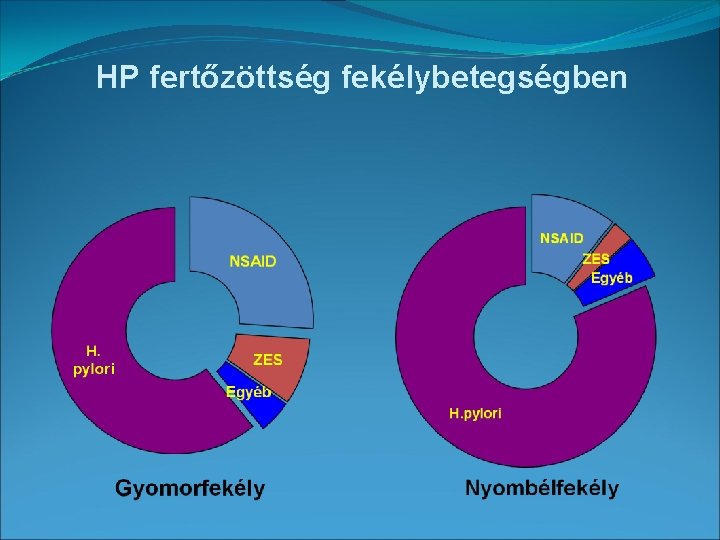 HP fertőzöttség fekélybetegségben 