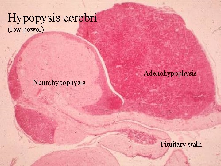 Hypopysis cerebri (low power) Adenohypophysis Neurohypophysis Pituitary stalk 