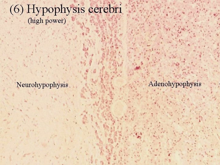 (6) Hypophysis cerebri (high power) Neurohypophysis Adenohypophysis 