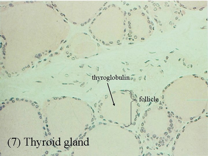 thyroglobulin follicle (7) Thyroid gland 