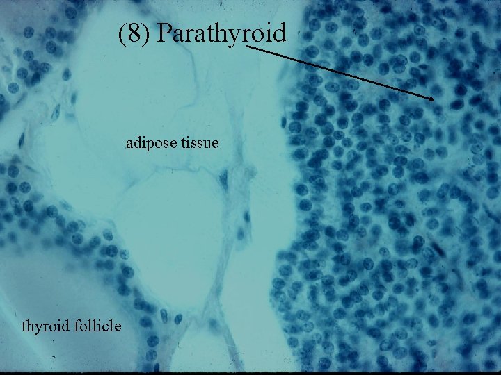 (8) Parathyroid adipose tissue thyroid follicle 