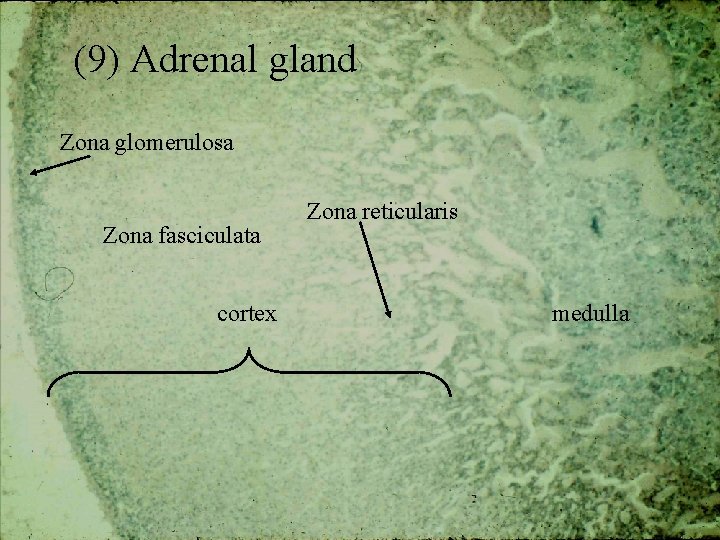 (9) Adrenal gland Zona glomerulosa Zona fasciculata cortex Zona reticularis medulla 