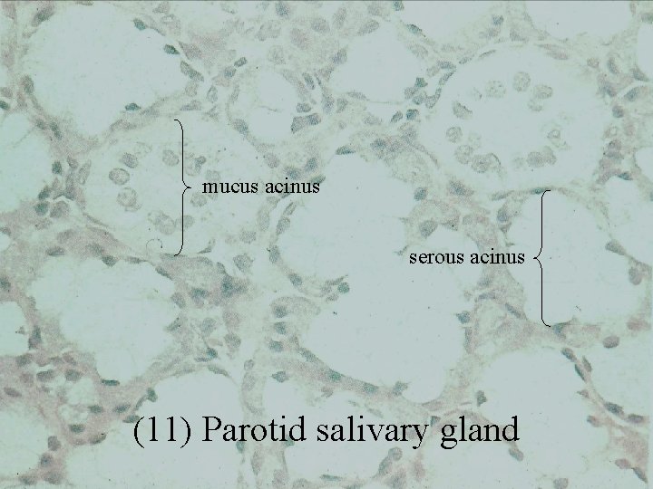 mucus acinus serous acinus (11) Parotid salivary gland 