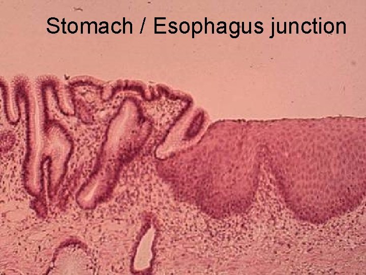 Stomach / Esophagus junction 