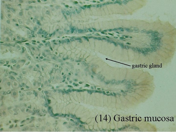 gastric gland (14) Gastric mucosa 