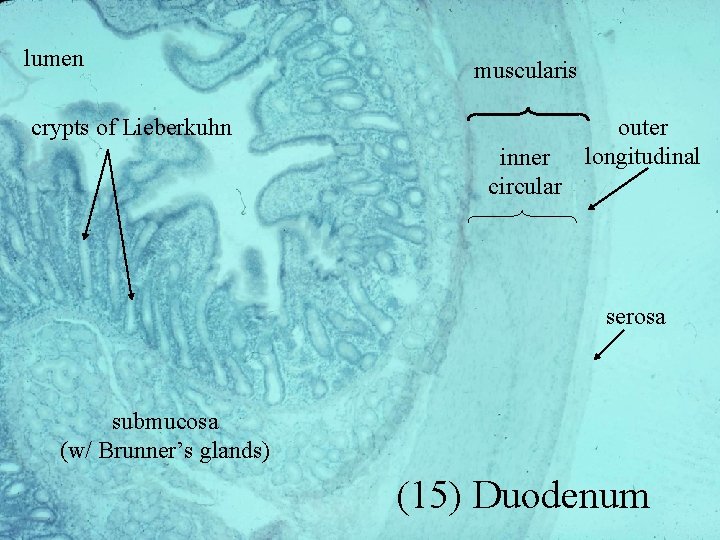 lumen muscularis crypts of Lieberkuhn inner circular outer longitudinal serosa submucosa (w/ Brunner’s glands)