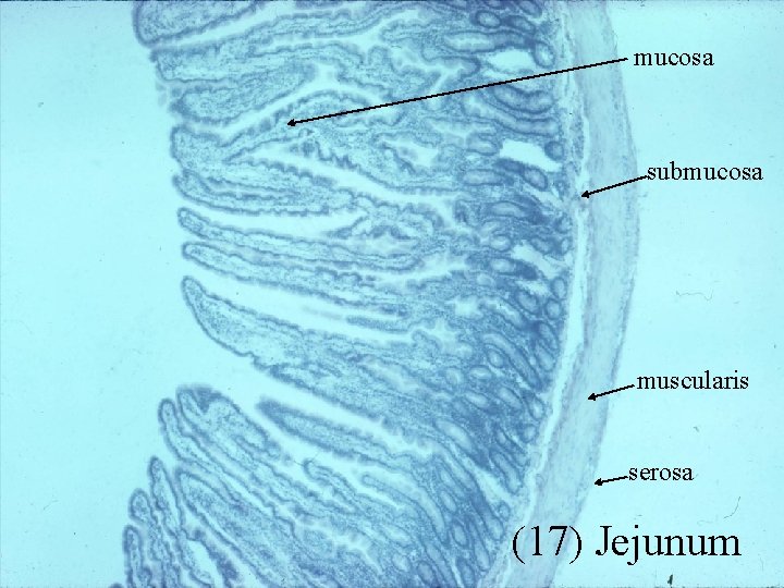 mucosa submucosa muscularis serosa (17) Jejunum 