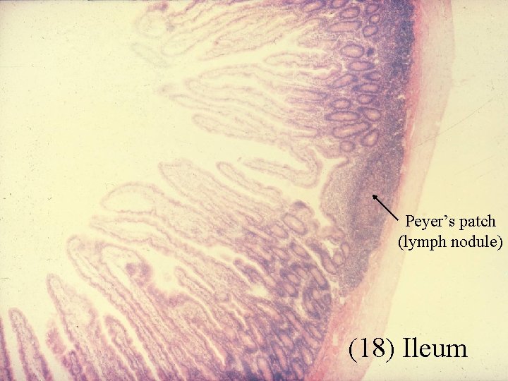 Peyer’s patch (lymph nodule) (18) Ileum 