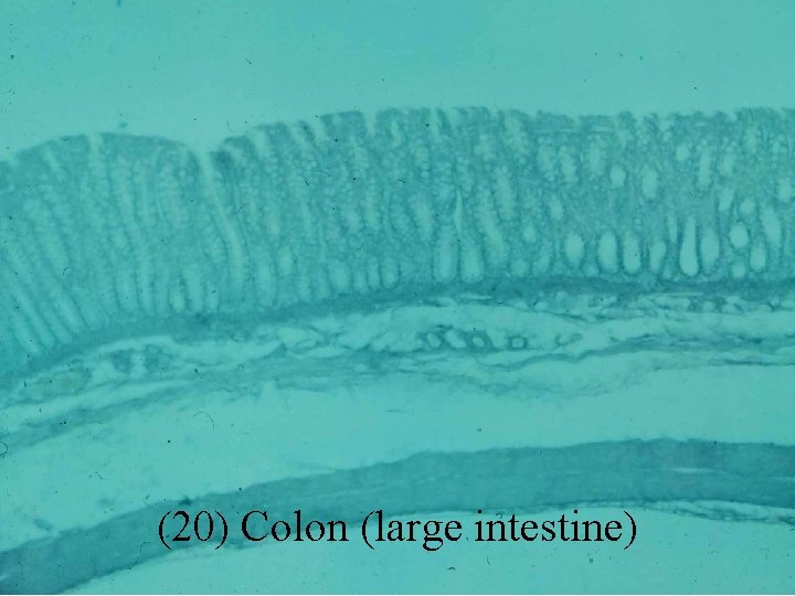 (20) Colon (large intestine) 