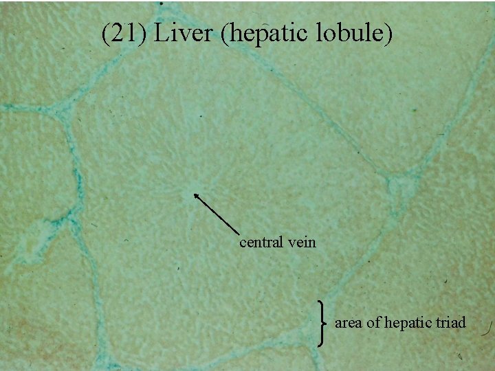 (21) Liver (hepatic lobule) central vein area of hepatic triad 