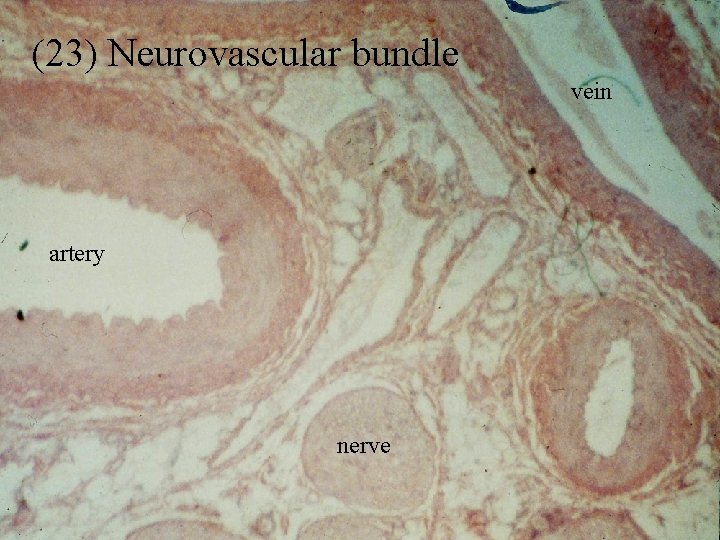 (23) Neurovascular bundle vein artery nerve 