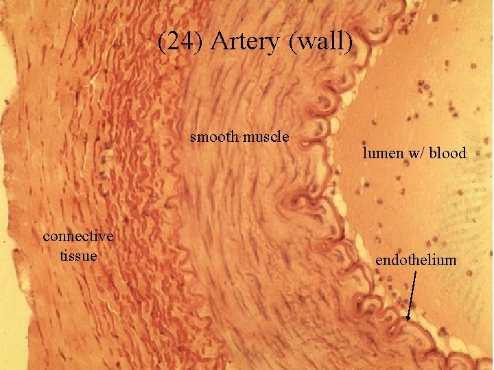 (24) Artery (wall) smooth muscle connective tissue lumen w/ blood endothelium 