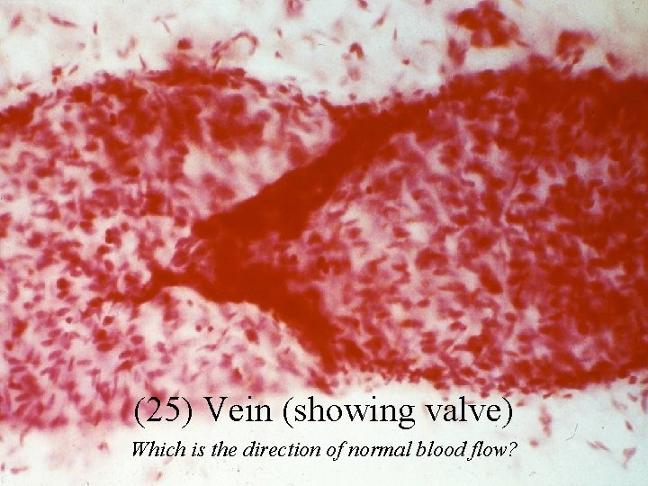 (25) Vein (showing valve) Which is the direction of normal blood flow? 