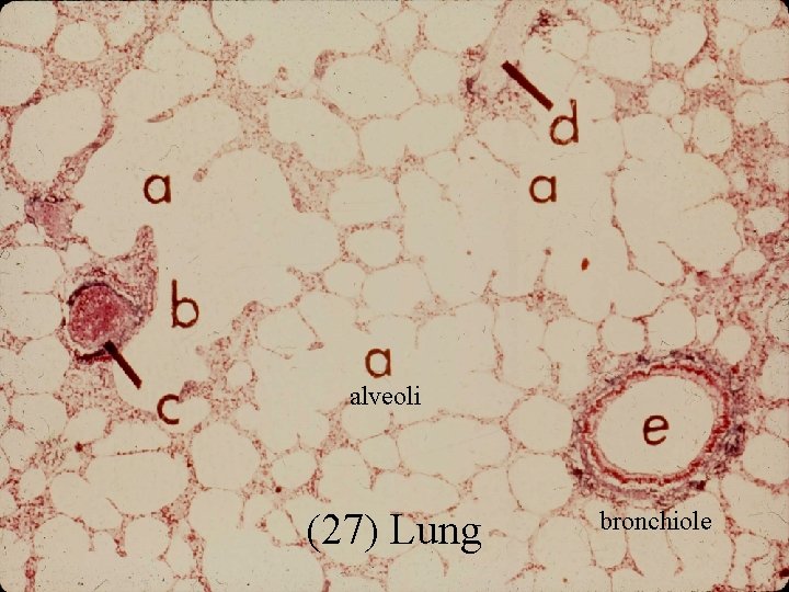 alveoli (27) Lung bronchiole 
