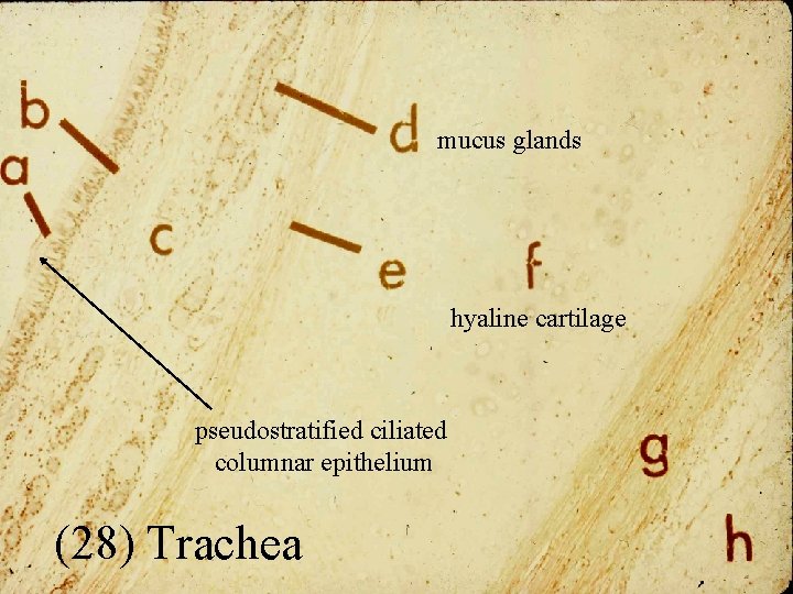 mucus glands hyaline cartilage pseudostratified ciliated columnar epithelium (28) Trachea 