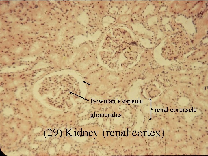 Bowman’s capsule glomerulus renal corpuscle (29) Kidney (renal cortex) 