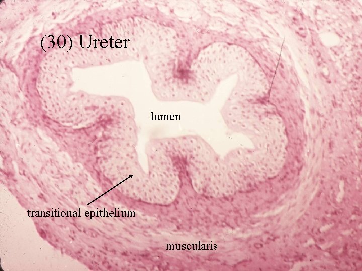 (30) Ureter lumen transitional epithelium muscularis 