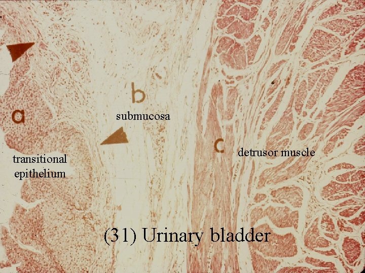 submucosa transitional epithelium detrusor muscle (31) Urinary bladder 