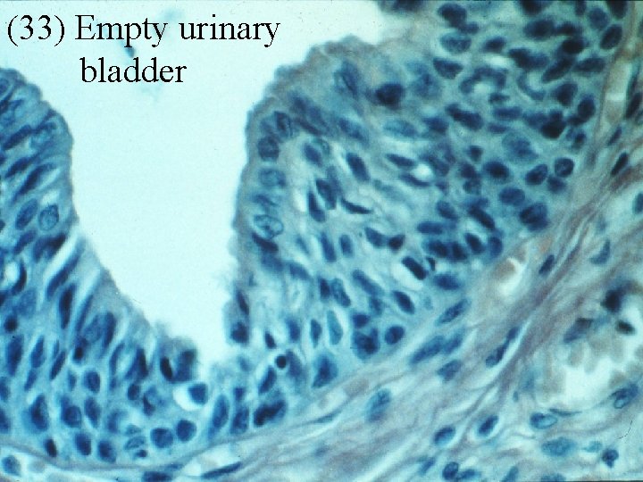 (33) Empty urinary bladder 