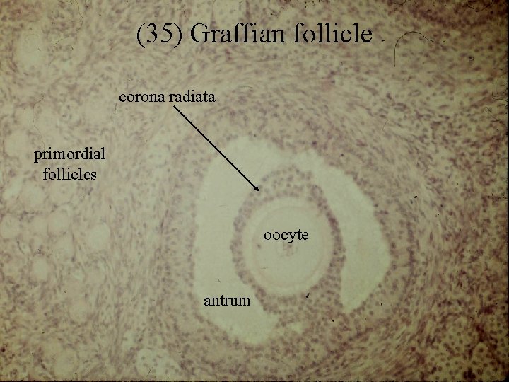 (35) Graffian follicle corona radiata primordial follicles oocyte antrum 