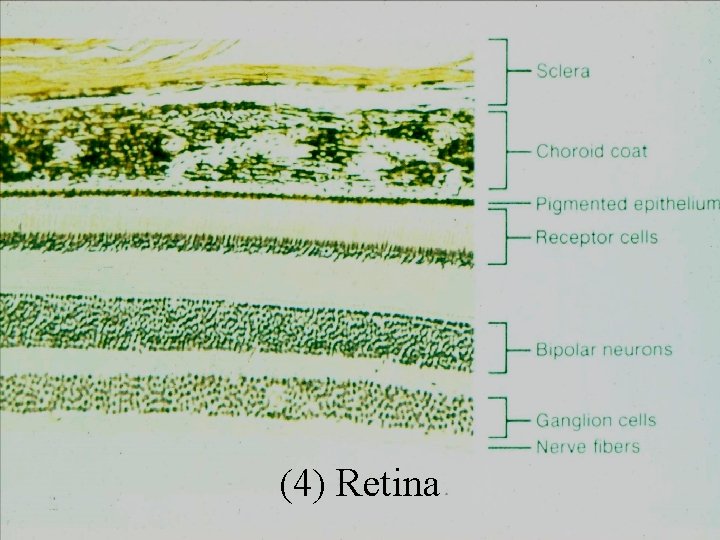 (4) Retina 