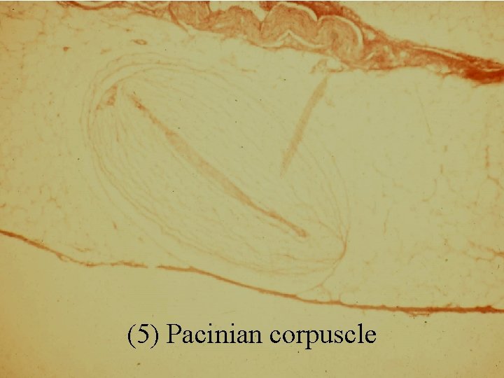 (5) Pacinian corpuscle 