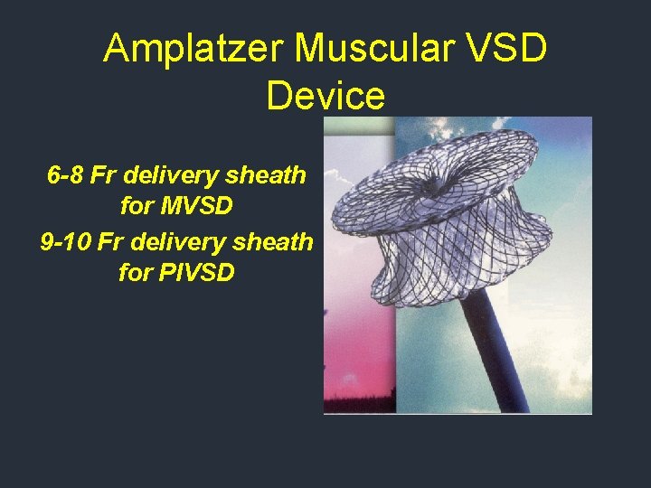 Amplatzer Muscular VSD Device 6 -8 Fr delivery sheath for MVSD 9 -10 Fr Amplatzer Muscular VSD Device 6 -8 Fr delivery sheath for MVSD 9 -10 Fr