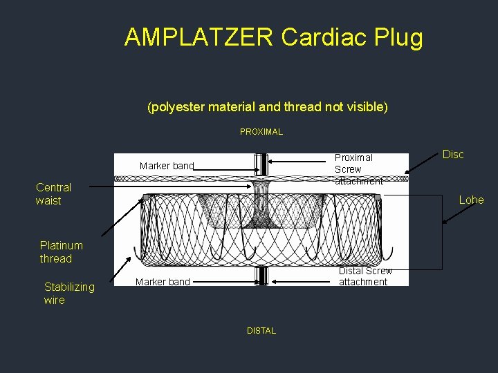 AMPLATZER Cardiac Plug (polyester material and thread not visible) PROXIMAL Proximal Screw attachment Marker AMPLATZER Cardiac Plug (polyester material and thread not visible) PROXIMAL Proximal Screw attachment Marker