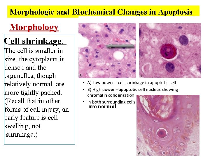 Morphologic and BIochemical Changes in Apoptosis Morphology Cell shrinkage. The cell is smaller in