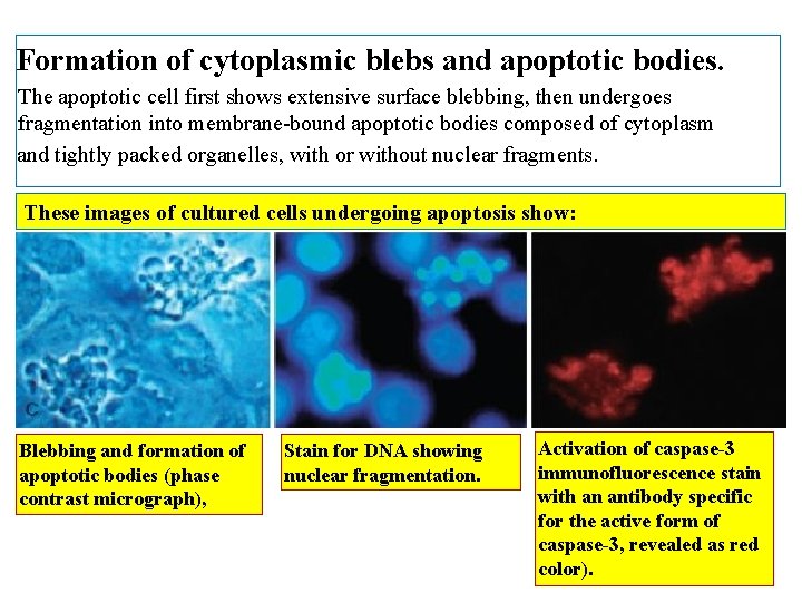 Formation of cytoplasmic blebs and apoptotic bodies. The apoptotic cell first shows extensive surface