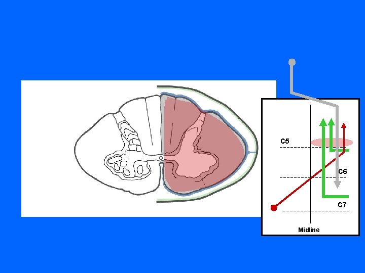 C 5 C 6 C 7 Midline 