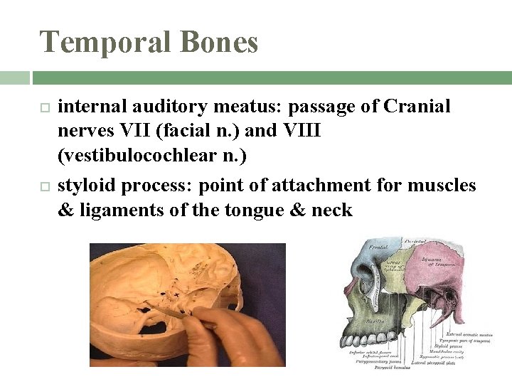 Temporal Bones internal auditory meatus: passage of Cranial nerves VII (facial n. ) and