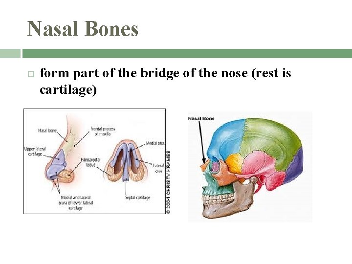 Nasal Bones form part of the bridge of the nose (rest is cartilage) 
