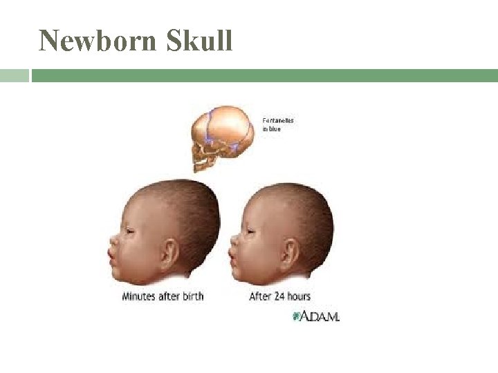 Newborn Skull 