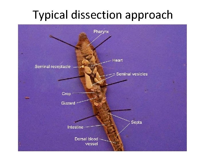 Typical dissection approach 