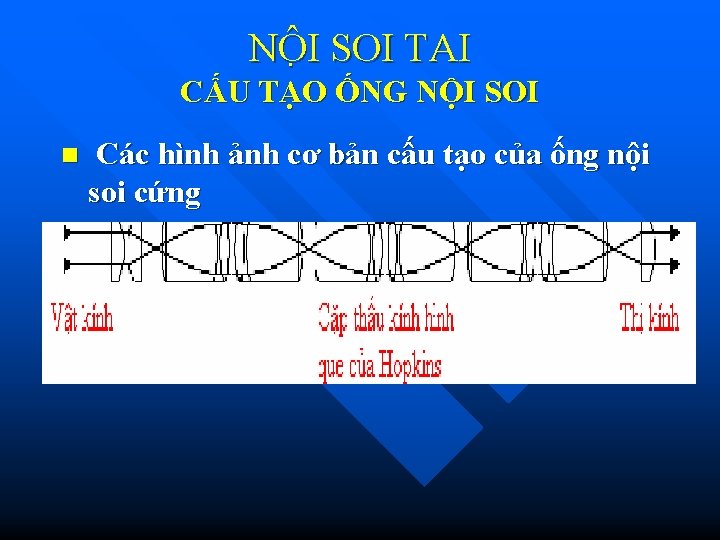 NÔ I SOI TAI CẤU TẠO ỐNG NỘI SOI n Các hình ảnh cơ NÔ I SOI TAI CẤU TẠO ỐNG NỘI SOI n Các hình ảnh cơ