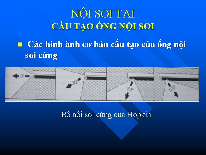 NÔ I SOI TAI CẤU TẠO ỐNG NỘI SOI n Các hình ảnh cơ NÔ I SOI TAI CẤU TẠO ỐNG NỘI SOI n Các hình ảnh cơ