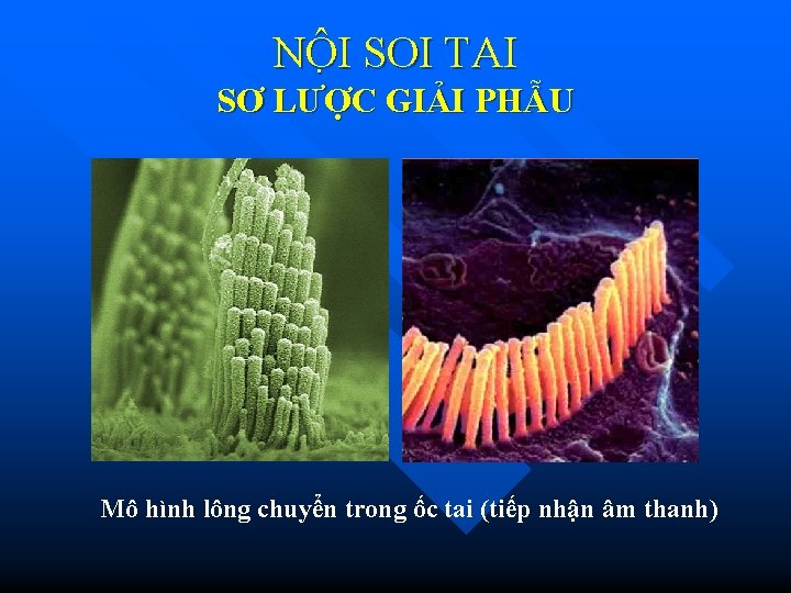 NÔ I SOI TAI SƠ LƯỢC GIẢI PHẪU Mô hình lông chuyển trong ốc NÔ I SOI TAI SƠ LƯỢC GIẢI PHẪU Mô hình lông chuyển trong ốc