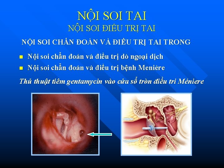 NÔ I SOI TAI NỘI SOI ĐIỀU TRỊ TAI NỘI SOI CHẨN ĐOÁN VÀ NÔ I SOI TAI NỘI SOI ĐIỀU TRỊ TAI NỘI SOI CHẨN ĐOÁN VÀ