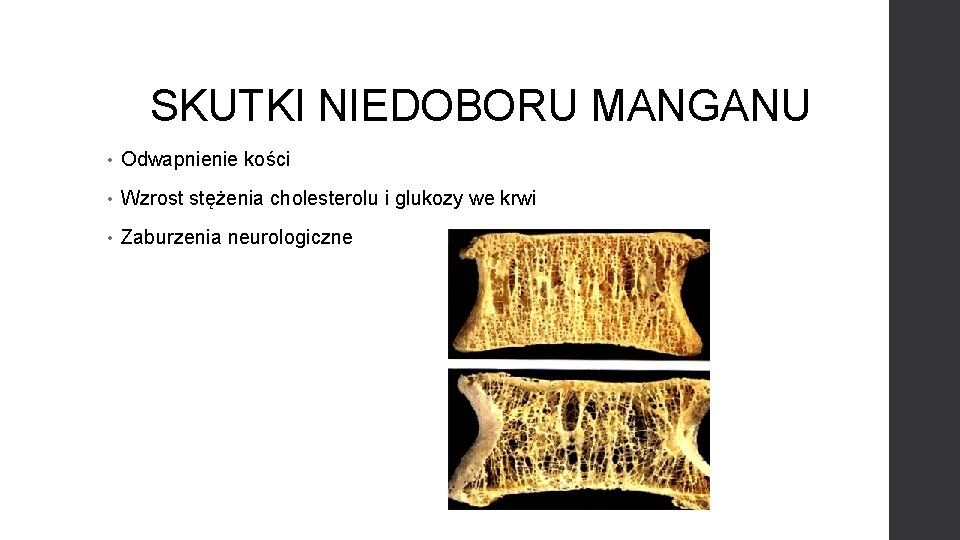 SKUTKI NIEDOBORU MANGANU • Odwapnienie kości • Wzrost stężenia cholesterolu i glukozy we krwi