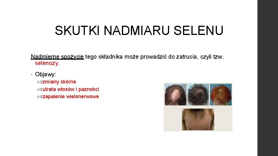 SKUTKI NADMIARU SELENU Nadmierne spożycie tego składnika może prowadzić do zatrucia, czyli tzw. selenozy.