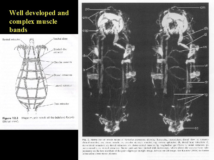 Well developed and complex muscle bands 