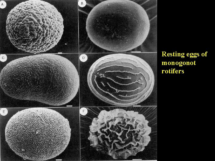 Resting eggs of monogonot rotifers 